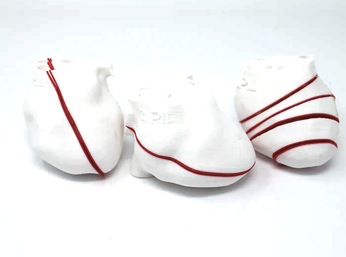 POCUS Heart Slice Models (Set of 3)