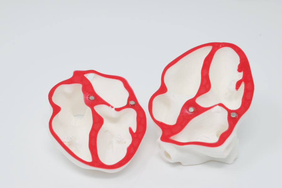 POCUS Heart Slice Models (Set of 3)